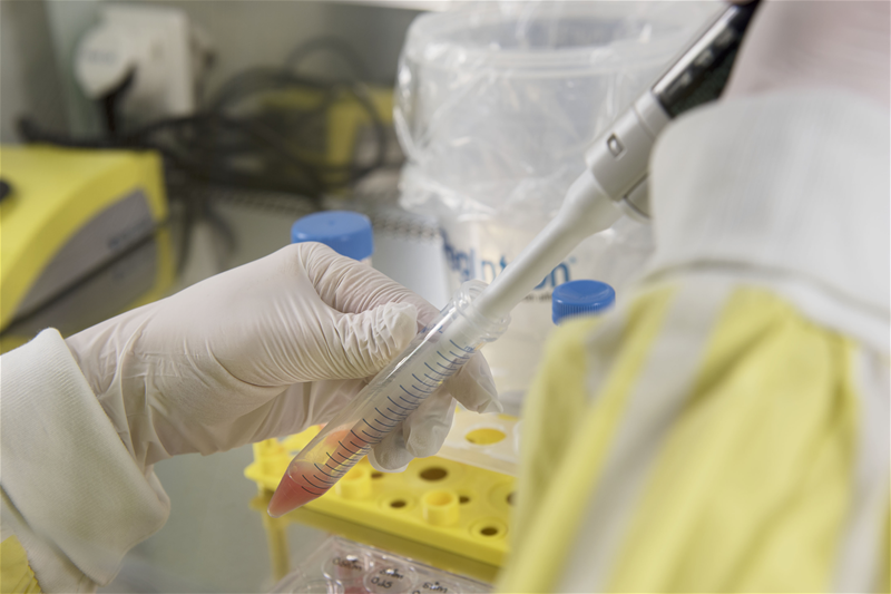 Forskning kring ataxi